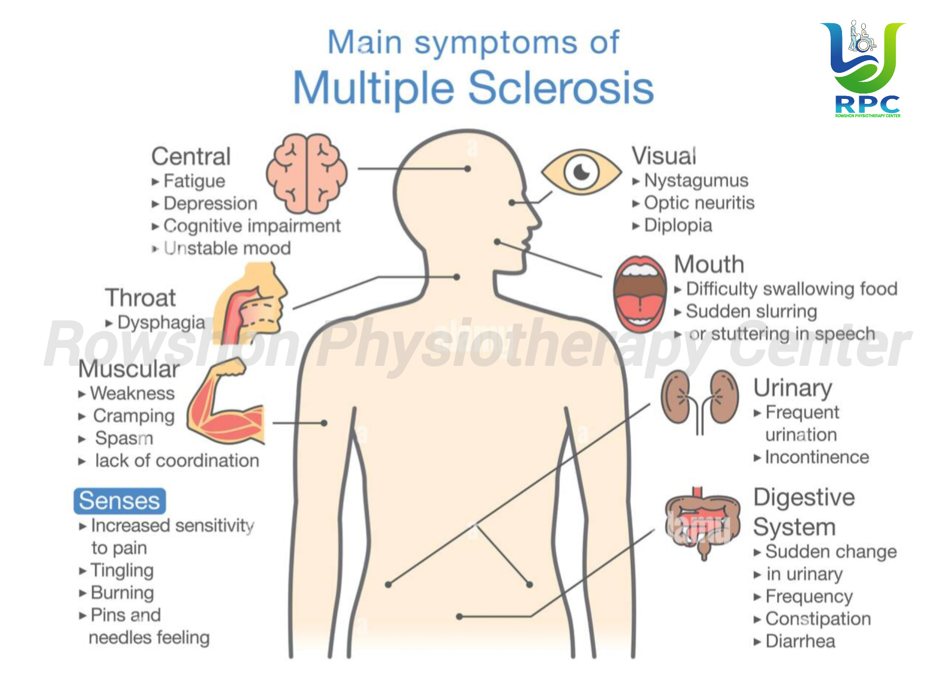 Multiple Sclerosis: একটি দীর্ঘমেয়াদী স্নায়বিক সমস্যা