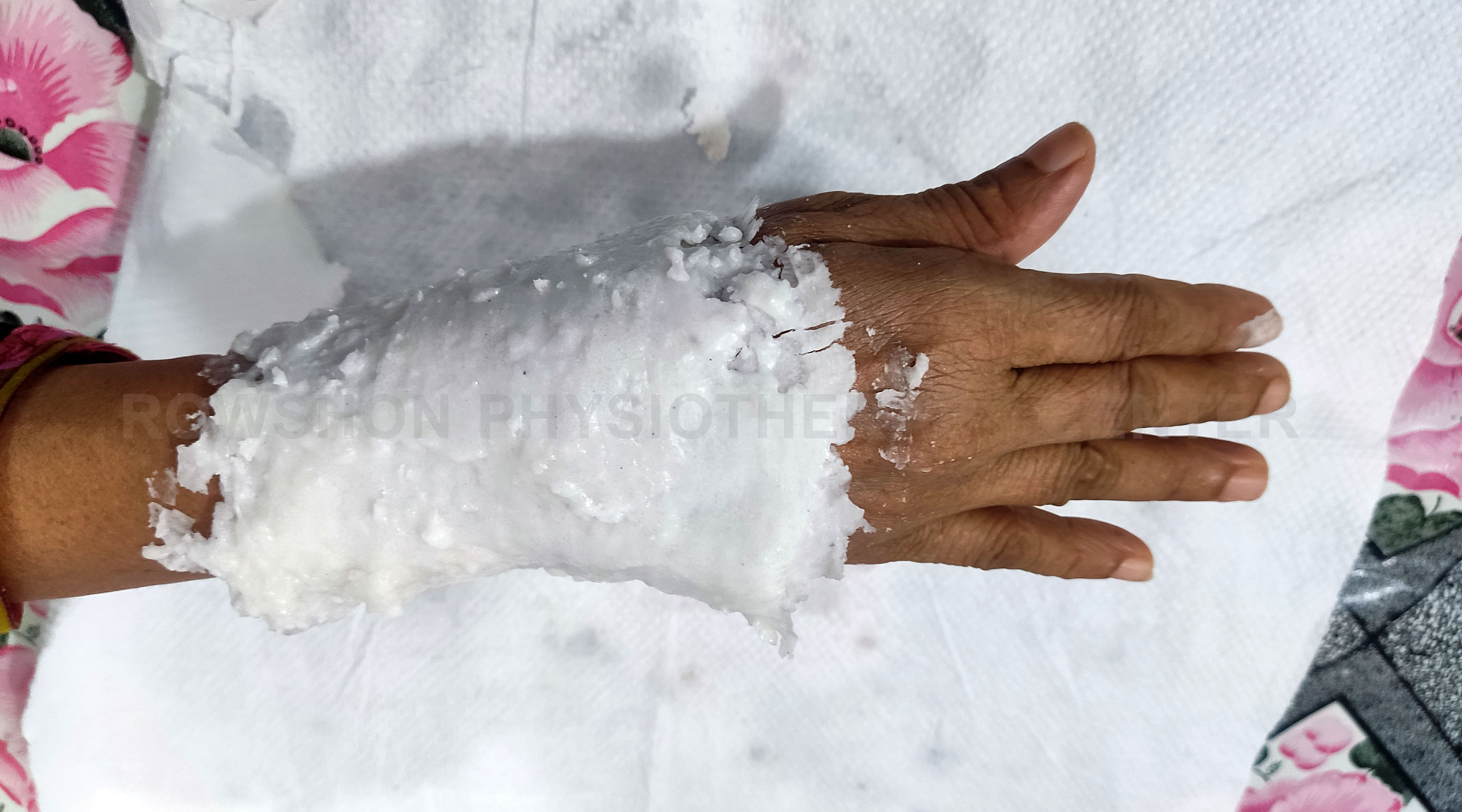 কনুই, কবজি, হাতের ব্যথা